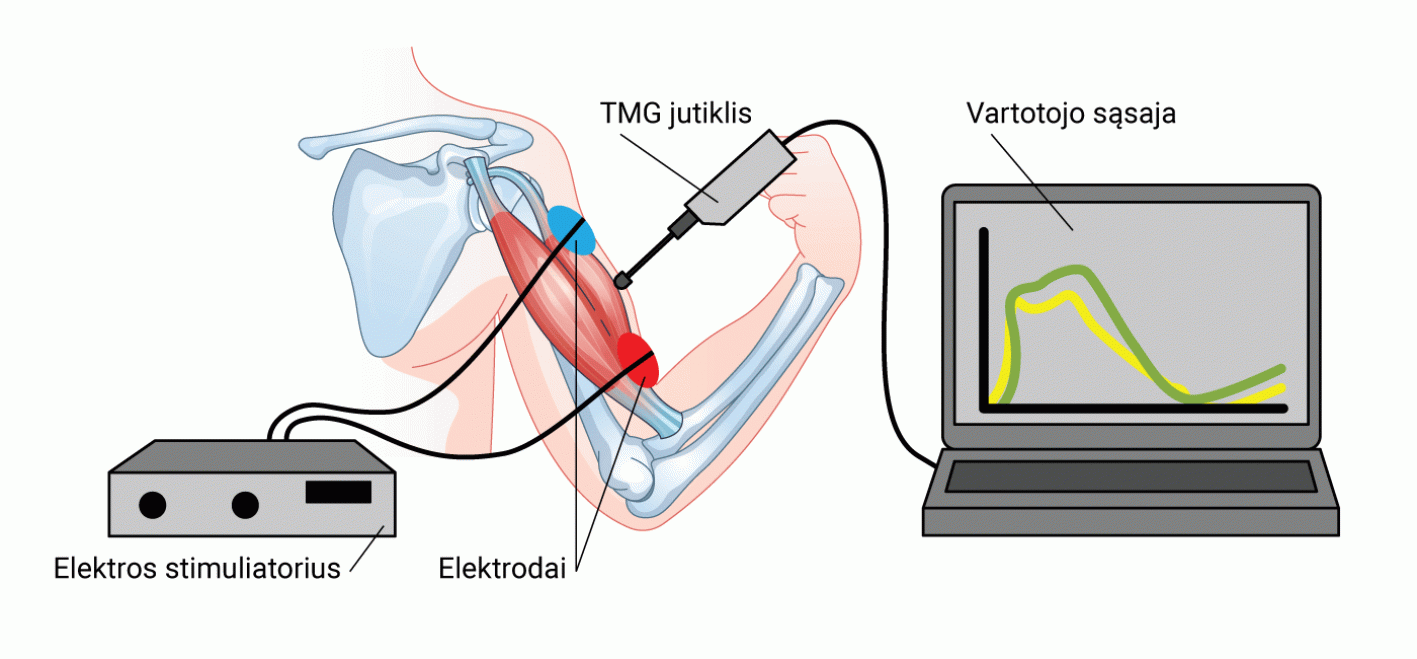 Tensiomiografijos (TMG) tyimo veikimo schema