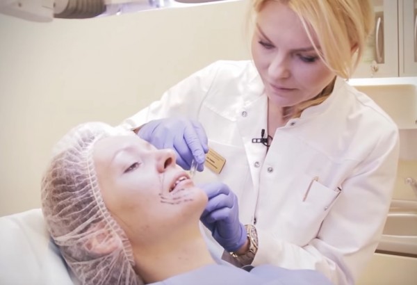 Rauksliu uzpildymas botulino toksino injekcijomis smakro ir lupu zonoje gyd. L.Duobiene