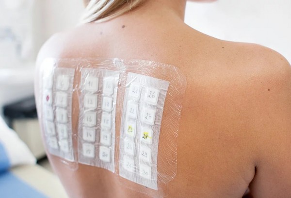 patch test