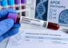 Apolipoproteino E APOE genotipavimas