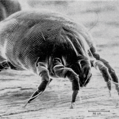 Dermatophagoides pteronyssinus