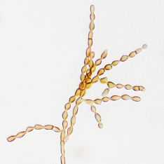 Cladosporium herbarum