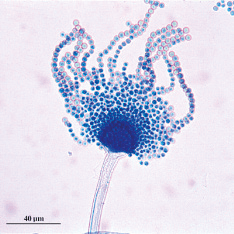 Aspergillus fumigatus