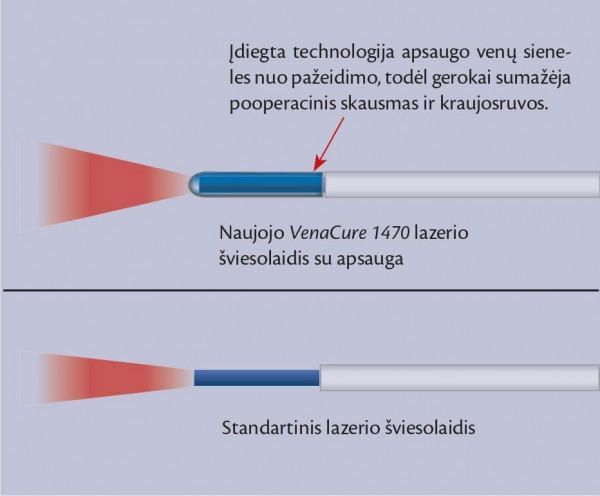 venu lazeris 1pav